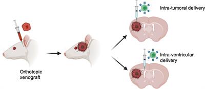 Strategies to Enhance the Efficacy of T-Cell Therapy for Central Nervous System Tumors